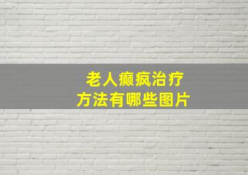 老人癫疯治疗方法有哪些图片