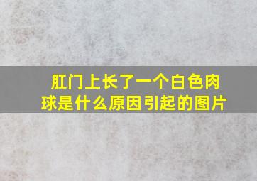 肛门上长了一个白色肉球是什么原因引起的图片