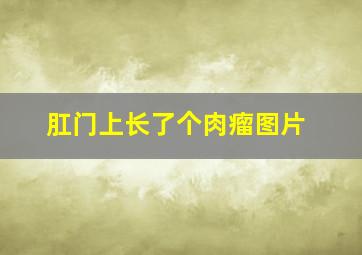 肛门上长了个肉瘤图片