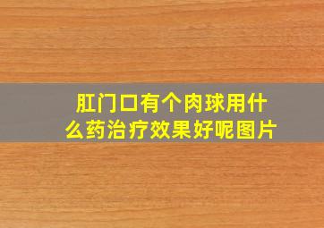 肛门口有个肉球用什么药治疗效果好呢图片