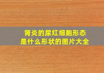 肾炎的尿红细胞形态是什么形状的图片大全