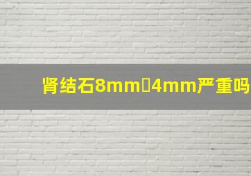 肾结石8mm✘4mm严重吗