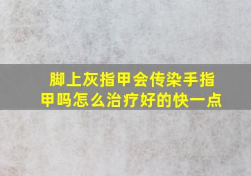 脚上灰指甲会传染手指甲吗怎么治疗好的快一点