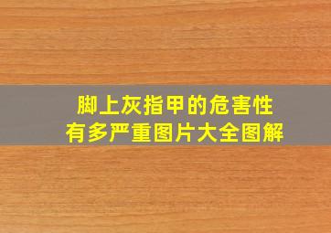 脚上灰指甲的危害性有多严重图片大全图解