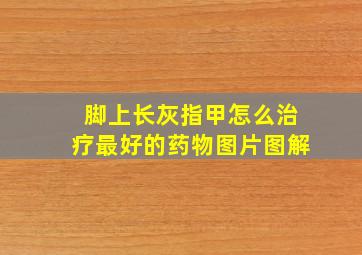 脚上长灰指甲怎么治疗最好的药物图片图解