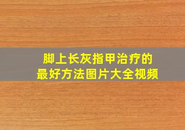 脚上长灰指甲治疗的最好方法图片大全视频