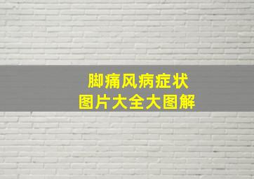 脚痛风病症状图片大全大图解