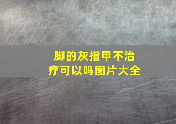 脚的灰指甲不治疗可以吗图片大全