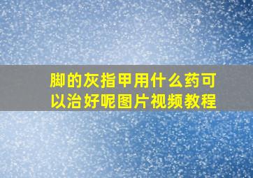 脚的灰指甲用什么药可以治好呢图片视频教程