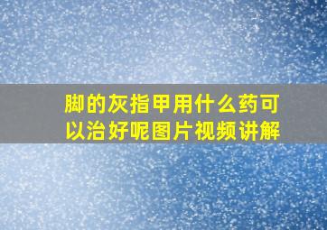 脚的灰指甲用什么药可以治好呢图片视频讲解