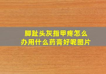 脚趾头灰指甲疼怎么办用什么药膏好呢图片