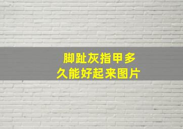 脚趾灰指甲多久能好起来图片