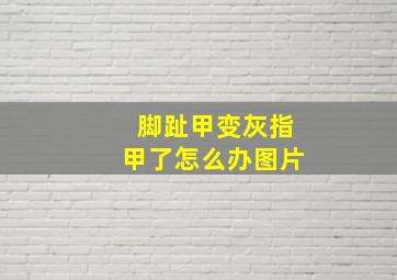 脚趾甲变灰指甲了怎么办图片