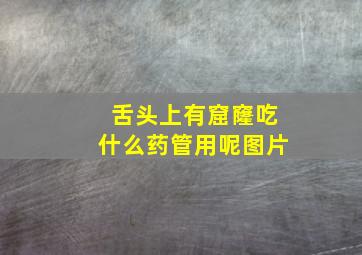 舌头上有窟窿吃什么药管用呢图片