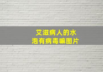 艾滋病人的水泡有病毒嘛图片