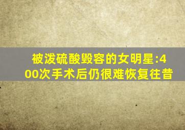 被泼硫酸毁容的女明星:400次手术后仍很难恢复往昔