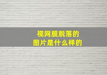 视网膜脱落的图片是什么样的