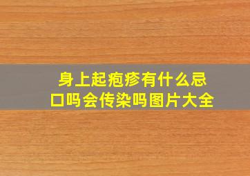 身上起疱疹有什么忌口吗会传染吗图片大全