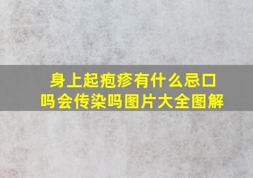 身上起疱疹有什么忌口吗会传染吗图片大全图解