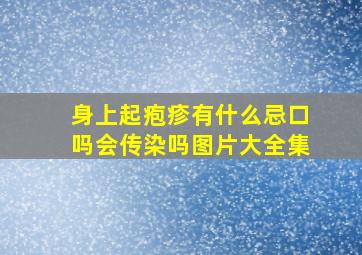 身上起疱疹有什么忌口吗会传染吗图片大全集