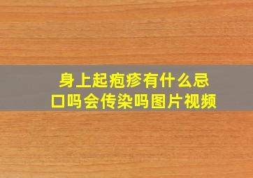 身上起疱疹有什么忌口吗会传染吗图片视频