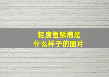 轻度鱼鳞病是什么样子的图片