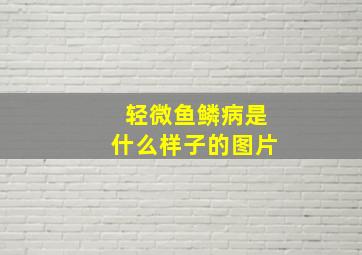 轻微鱼鳞病是什么样子的图片