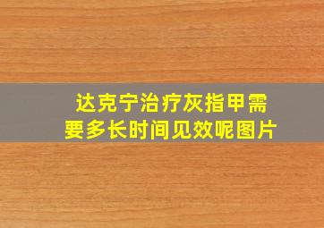 达克宁治疗灰指甲需要多长时间见效呢图片