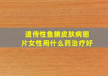 遗传性鱼鳞皮肤病图片女性用什么药治疗好