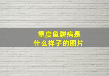 重度鱼鳞病是什么样子的图片