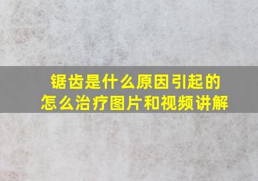 锯齿是什么原因引起的怎么治疗图片和视频讲解