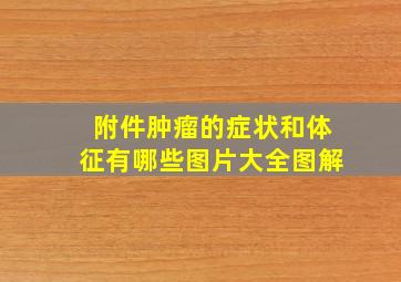 附件肿瘤的症状和体征有哪些图片大全图解