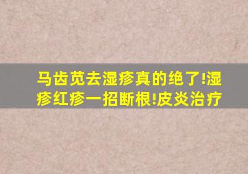 马齿苋去湿疹真的绝了!湿疹红疹一招断根!皮炎治疗