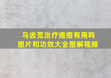 马齿苋治疗痘痘有用吗图片和功效大全图解视频