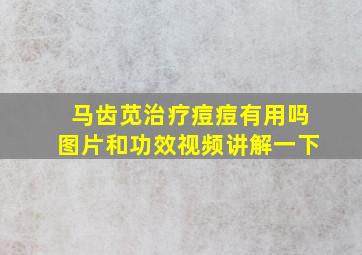 马齿苋治疗痘痘有用吗图片和功效视频讲解一下