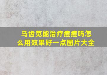 马齿苋能治疗痘痘吗怎么用效果好一点图片大全