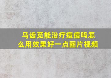 马齿苋能治疗痘痘吗怎么用效果好一点图片视频