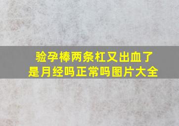 验孕棒两条杠又出血了是月经吗正常吗图片大全