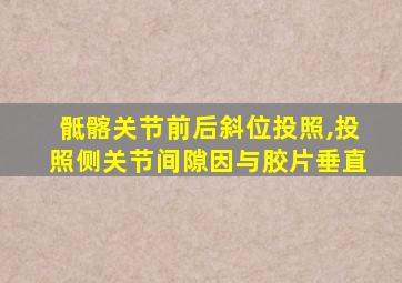 骶髂关节前后斜位投照,投照侧关节间隙因与胶片垂直