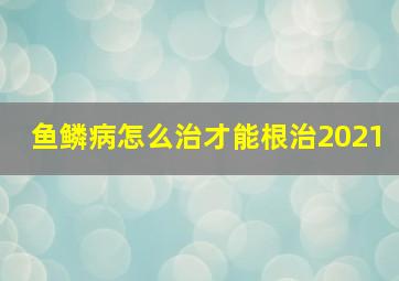 鱼鳞病怎么治才能根治2021