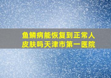 鱼鳞病能恢复到正常人皮肤吗天津市第一医院