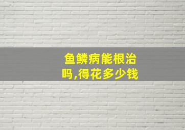 鱼鳞病能根治吗,得花多少钱