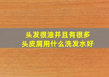 头发很油并且有很多头皮屑用什么洗发水好