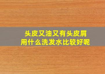 头皮又油又有头皮屑用什么洗发水比较好呢