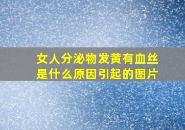 女人分泌物发黄有血丝是什么原因引起的图片