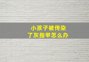 小孩子被传染了灰指甲怎么办