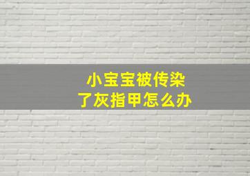 小宝宝被传染了灰指甲怎么办