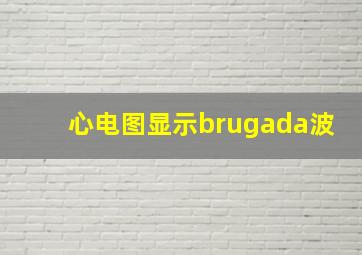 心电图显示brugada波