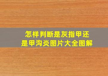 怎样判断是灰指甲还是甲沟炎图片大全图解