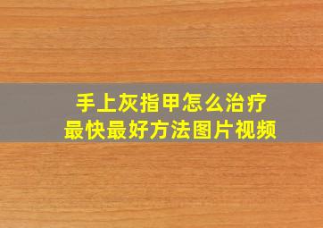 手上灰指甲怎么治疗最快最好方法图片视频